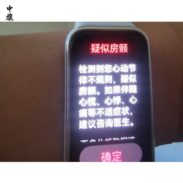 智能手環(huán)測血壓靠譜嗎？